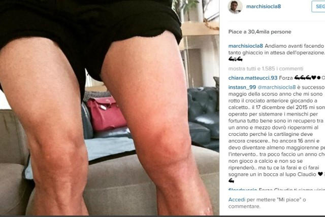 Marchisio: “Tanto ghiaccio in attesa dell’operazione” preview