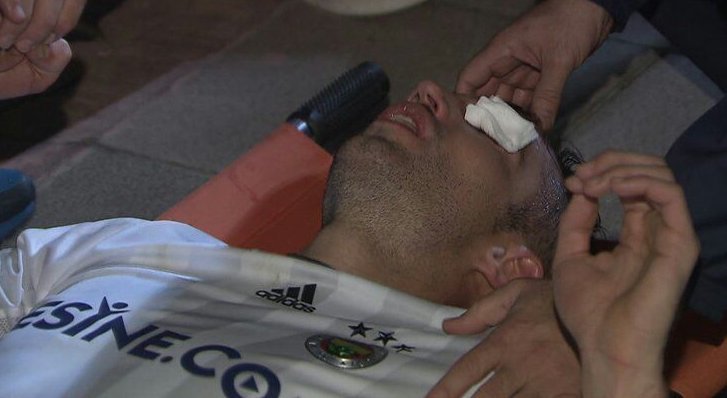 Medico Fenerbahce: “Van Persie sta meglio. E sui soccorsi…” preview