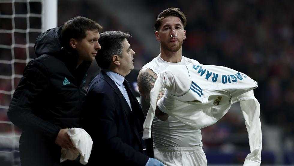 Real, niente APOEL per Sergio Ramos: frattura al setto nasale per lo spagnolo article-post