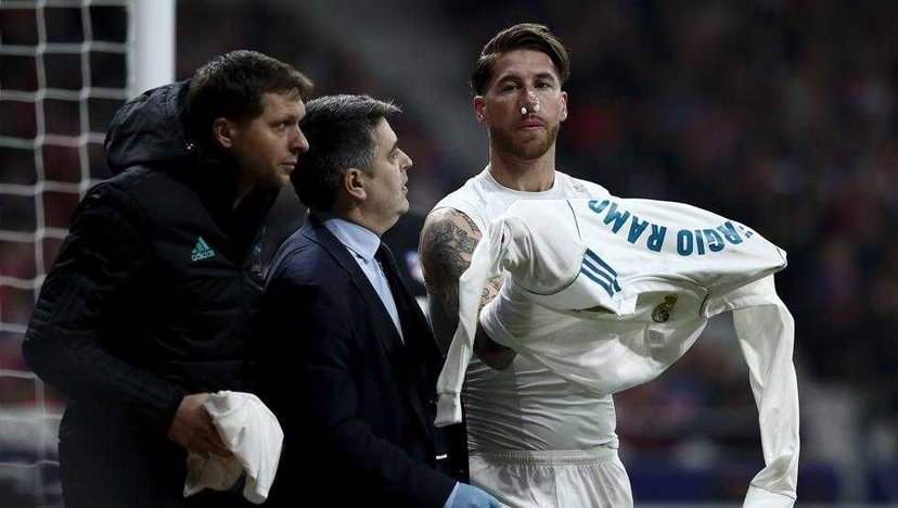 Real, niente APOEL per Sergio Ramos: frattura al setto nasale per lo spagnolo preview