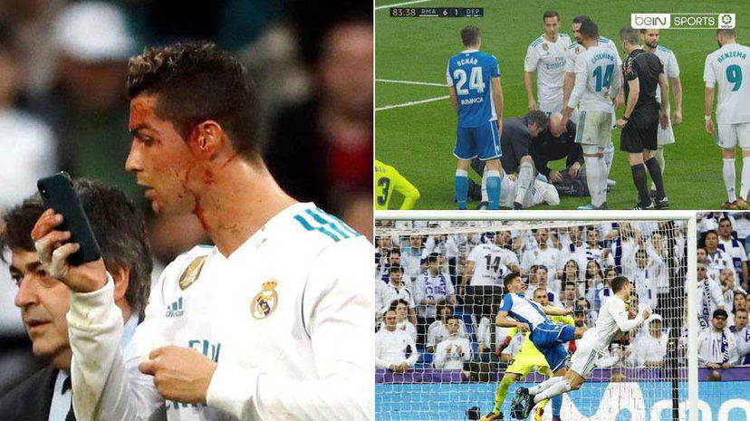 Cristiano Ronaldo, gol e ferita alla testa: chiede un telefono per… specchiarsi! preview