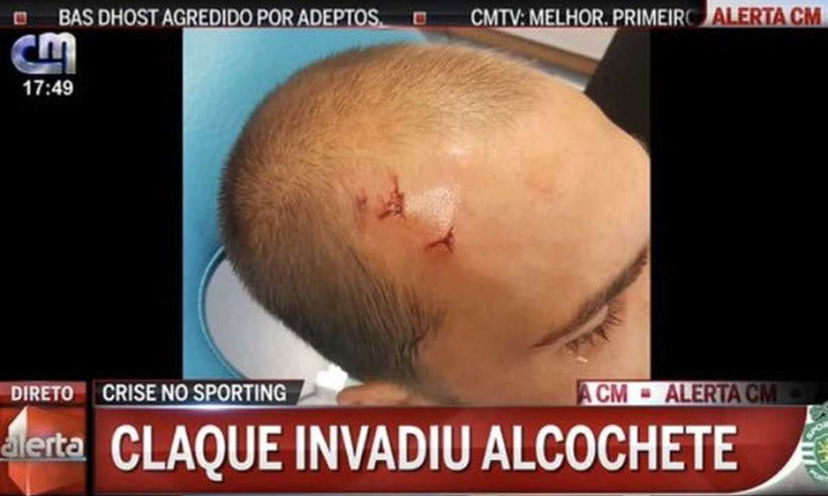 Sporting Lisbona shock: ultras incappucciati aggrediscono Rui Patricio, Carvalho e non solo preview