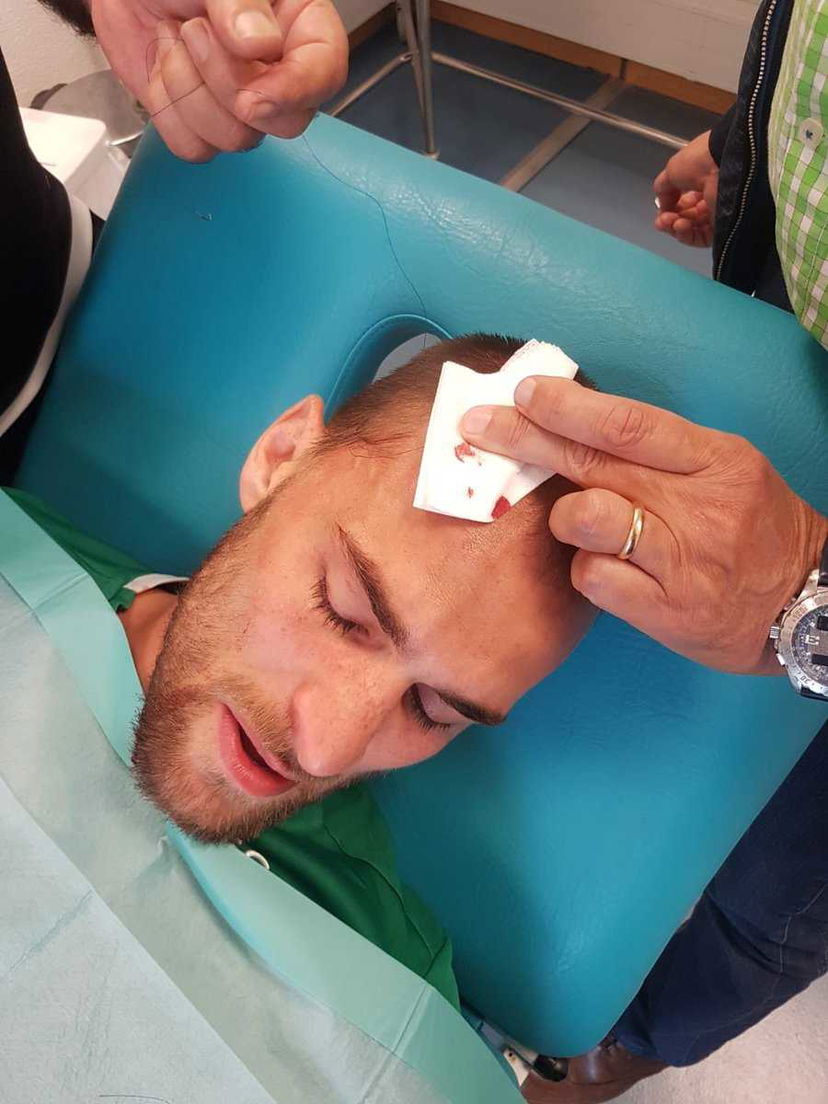 Sporting Lisbona: il video dopo l’aggressione negli spogliatoi preview