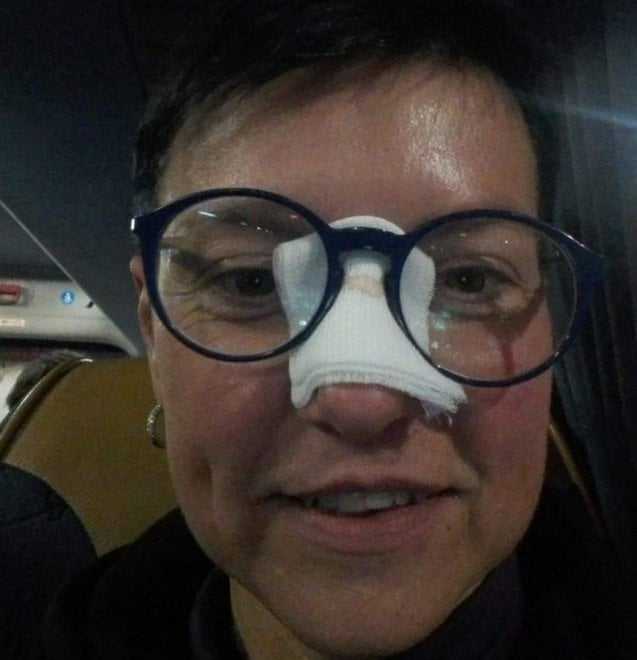 Juve, tifosa colpita al naso da un tiro sballato di Ronaldo: “Ora invitami a cena!” preview