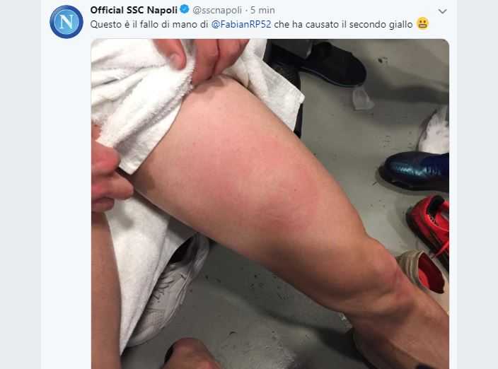 Napoli-tweet: “Questo è il fallo di mano di Fabian Ruiz che ha causato il secondo giallo” preview