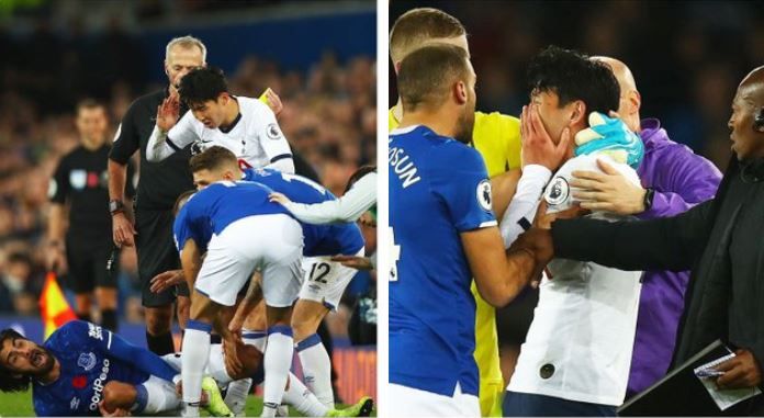 Everton, infortunio André Gomes: frattura scomposta della caviglia, oggi l’operazione preview