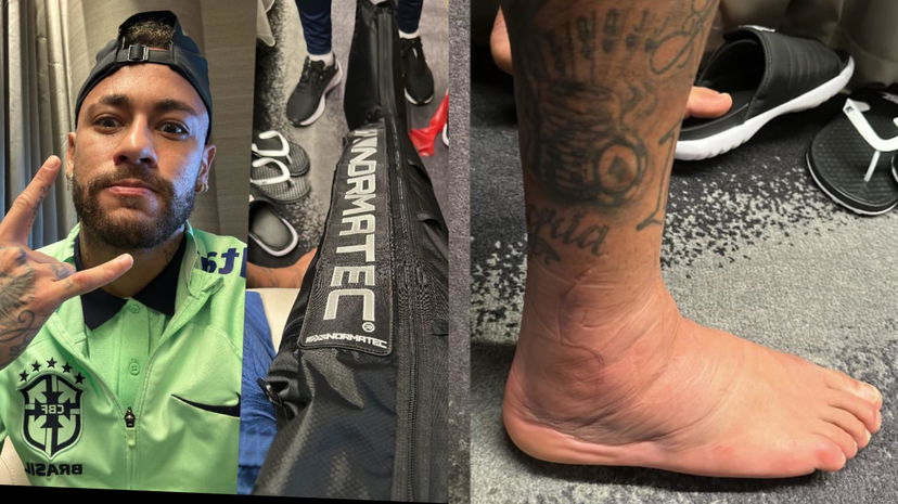 Neymar lavora per recuperare, ma la caviglia fa paura. La foto preview