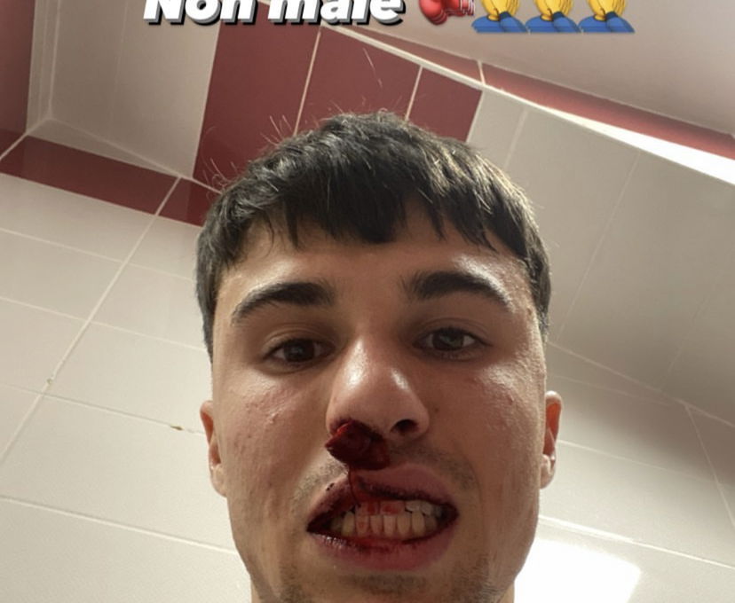 Sivasspor-Fiorentina, un tifoso turco colpisce con un pugno Bianco preview