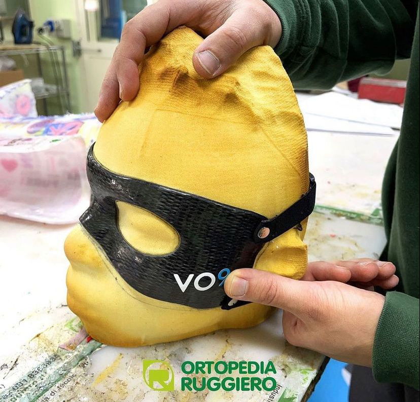 Buone notizie per Osimhen, la nuova maschera è pronta preview