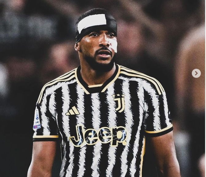 Bremer e il “turbante” come Chiellini: “Scusa Giorgio, l’ho preso in prestito” preview