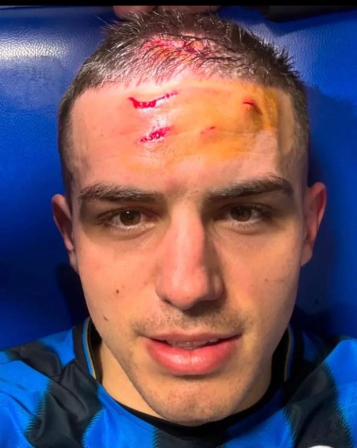 Krstovic ci mette la faccia: l’attaccante mostra i segni dei tacchetti del rigore decisivo preview