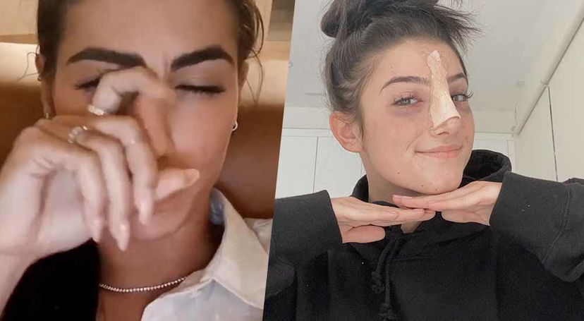 Giulia De Lellis e Charli D’Amelio di TikTok operate al naso: ecco perché preview