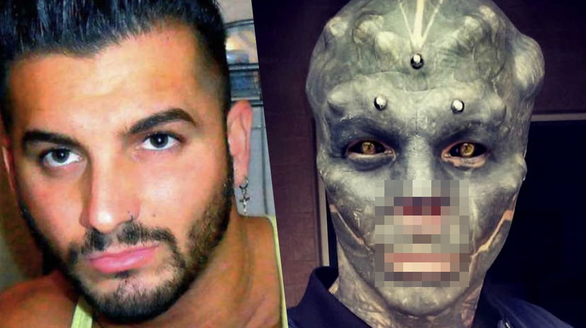 Anthony Loffredo, il ragazzo che si è fatto asportare naso e orecchie per sembrare un alieno preview