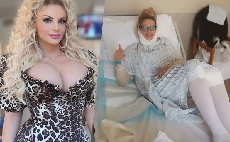 Francesca Cipriani in ospedale dopo un altro intervento di chirurgia estetica: ecco cosa ha fatto preview