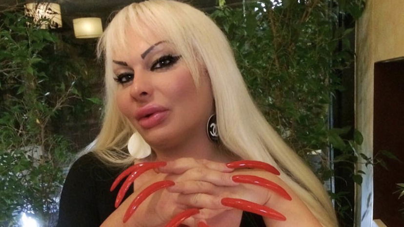 Elenoire Ferruzzi, si aggravano le sue condizioni: “Non risponde alle cure, il primario dice di prepararsi al peggio” preview