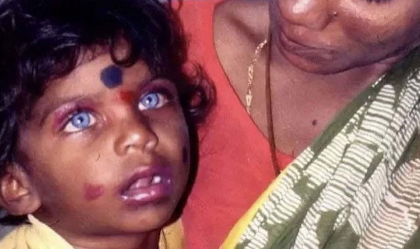 Akash Kumar: “Questo bambino sono io”, ma la foto si trova anche su Google preview