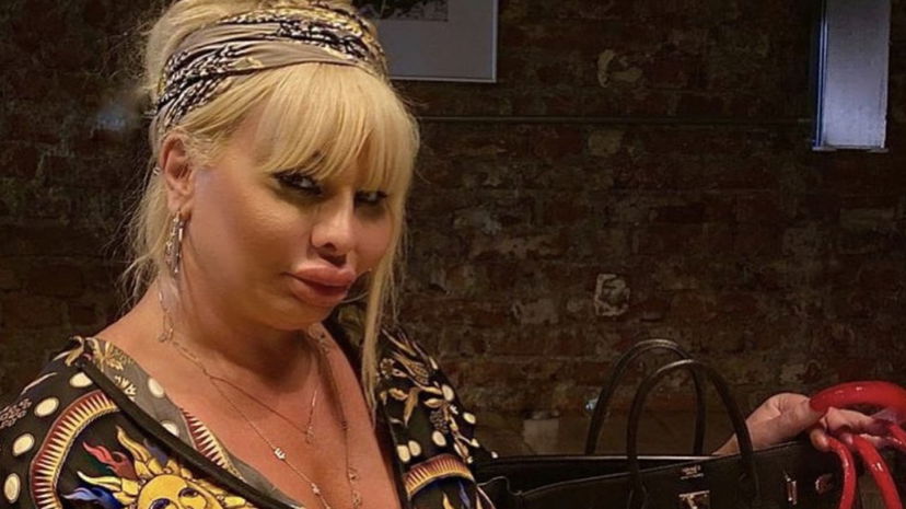 Elenoire Ferruzzi, buone notizie dall’ospedale: “Inaspettatamente è migliorata” preview