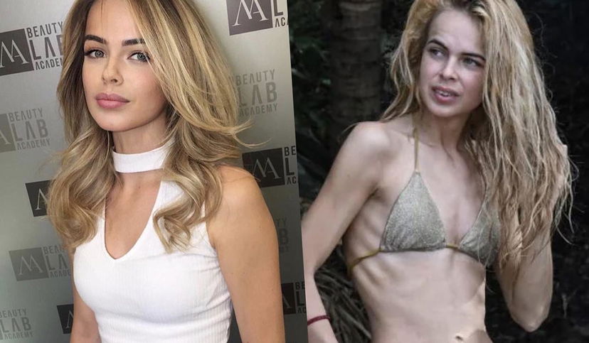 Drusilla Gucci prima e dopo L’isola dei Famosi: “Peso 43 kg” preview