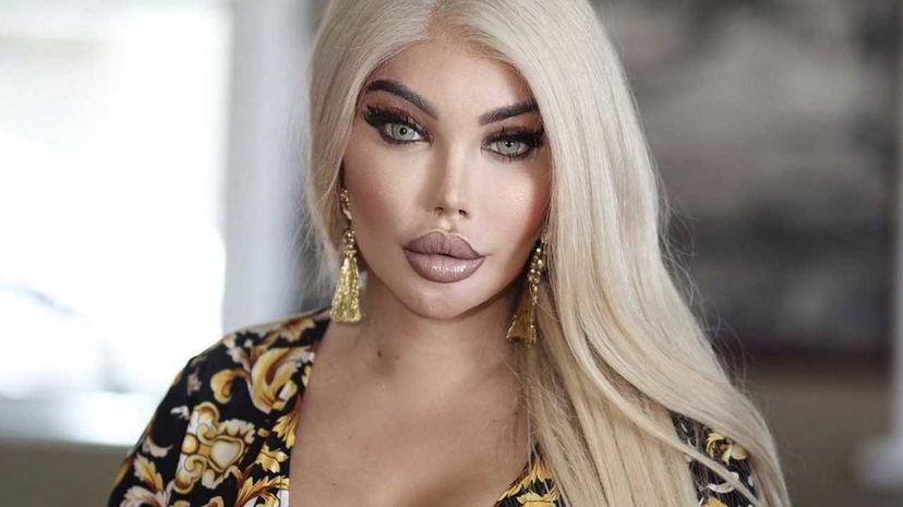 Jessica Alves: in Brasile parlano di una nuova illegale operazione a cui si sottoporrà preview