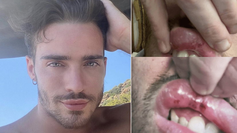 Amici, ex ballerino picchiato perché gay: “Aggressione omofoba, accerchiato da 6” preview