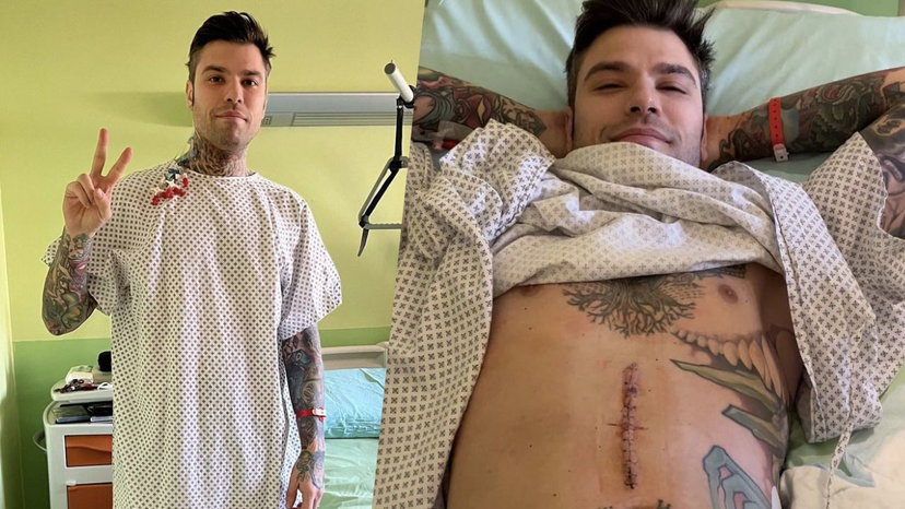 Fedez, tumore al pancreas: “Operazione durata 6 ore” preview