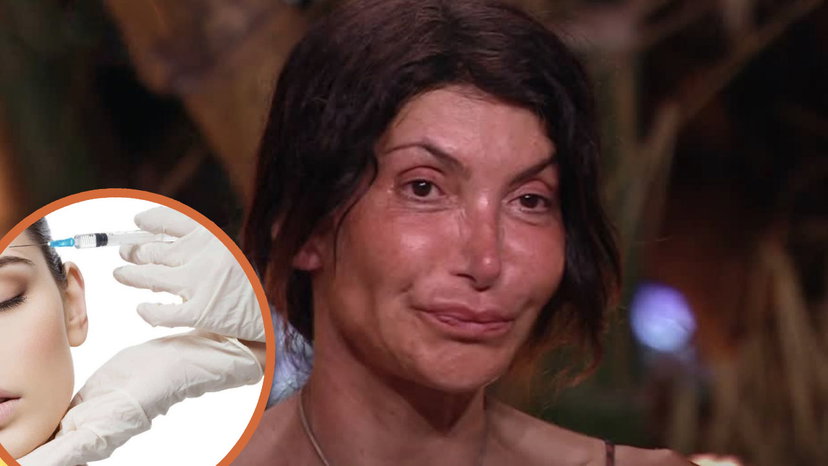 Medico fa insinuazioni su L’Isola dei Famosi: “Hanno un chirurgo estetico che ritocca i naufraghi” preview