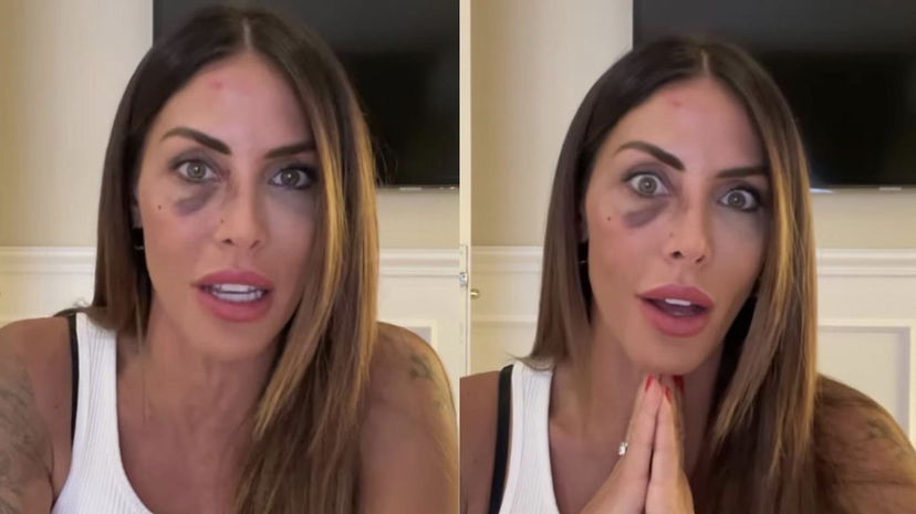 Tavassi, confessione choc sull’ex: “Bastonate in testa, naso rotto con le chiavi” preview