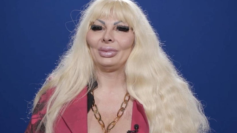 Elenoire Ferruzzi svela quanto ha speso in chirurgia e risponde agli insulti preview