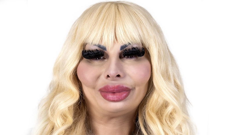 La Ferruzzi risponde a chi le chiede se è operata e mette le cose in chiaro preview