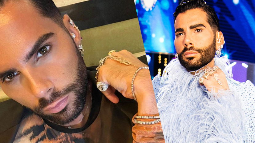 Federico Fashion Style confessa la verità sulla sua situazione sentimentale: “Single? Ecco chi amo davvero” preview