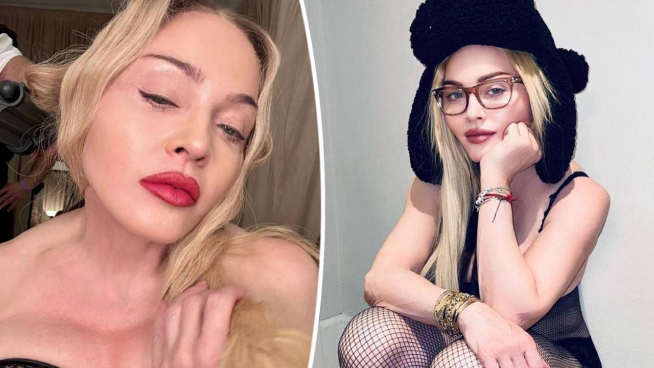 Madonna è stata salvata col Narcan