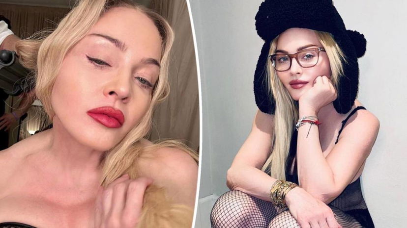 Madonna rianimata con un’iniezione di Narcan: “Riportata in vita in extremis” preview