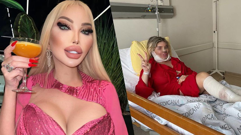 Jessica Alves, il nuovo intervento per “dimostrare dieci anni di meno” preview