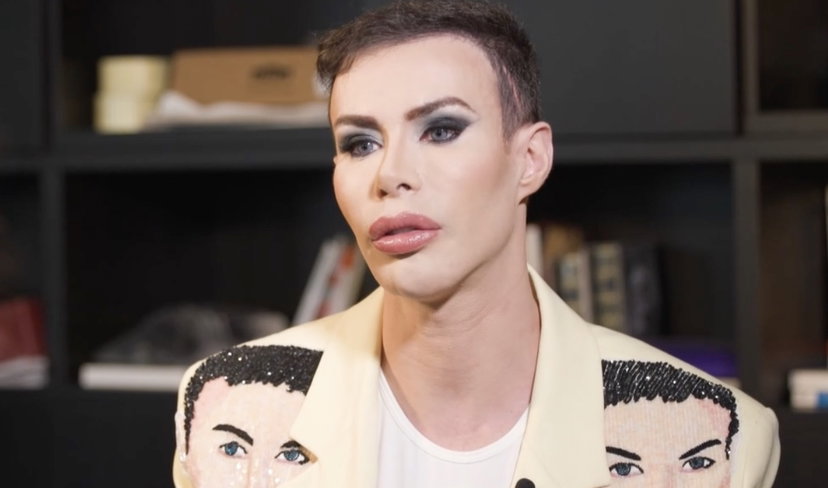 Angelo Sanzio si commuove guardando le foto di com’era prima di rifarsi: “Ecco perché ho cambiato faccia” preview