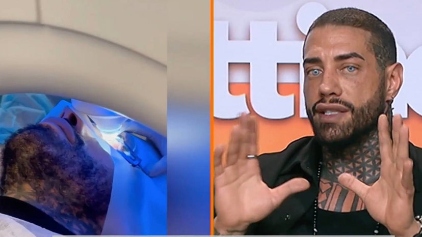 Ricovero di Francesco Chiofalo: “Cecità temporanea e attacco epilettico” preview