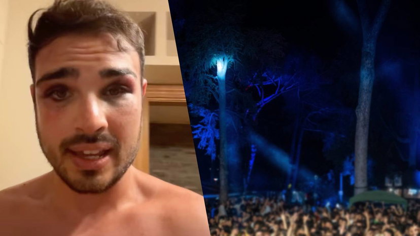 Aggressione in un locale di Roma, replica condivisa dal Giam: “Condanniamo ogni forma di violenza” preview