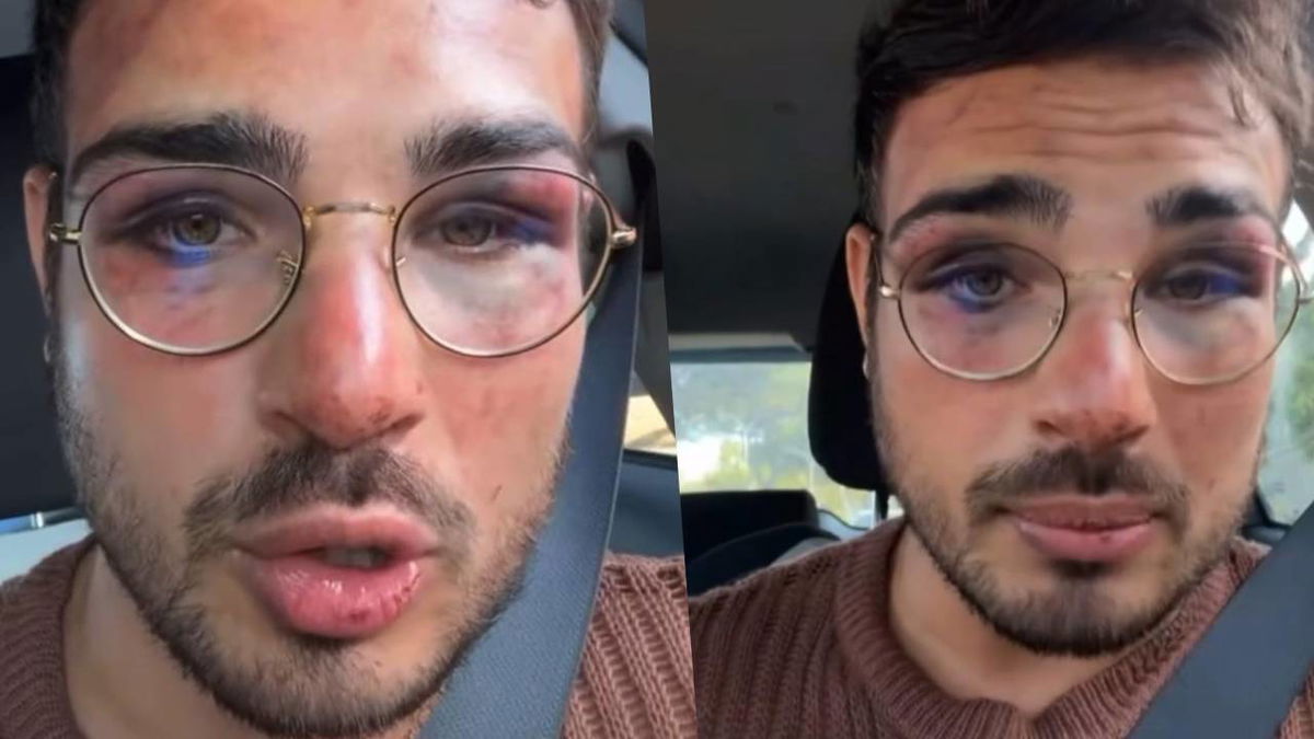 Ragazzo rapinato al GIAM di Roma, lui accusa lo staff: “Hanno aggredito me” article-post