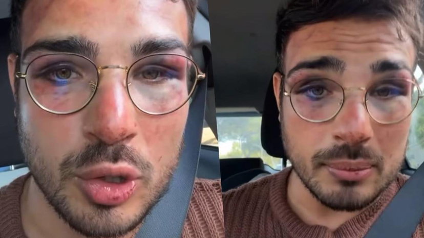 Ragazzo rapinato al GIAM di Roma, lui accusa lo staff: “Hanno aggredito me” preview