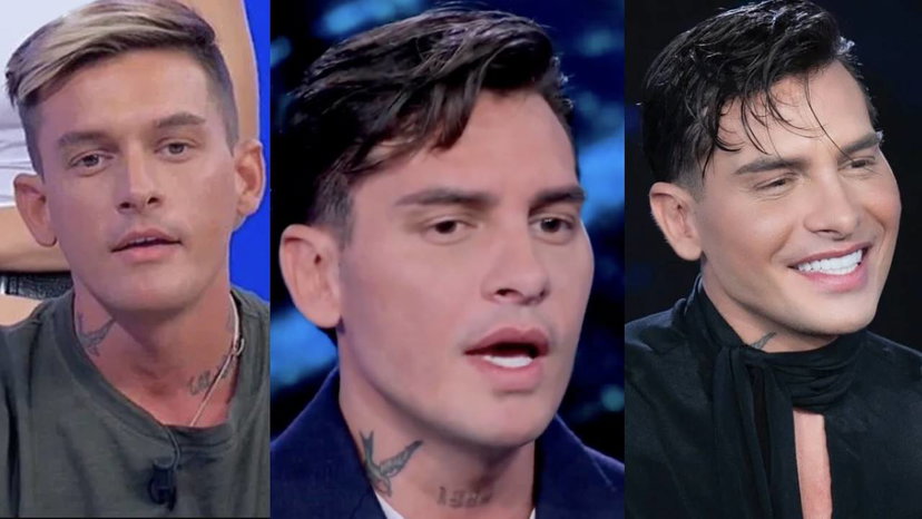 Alessandro Basciano svela cosa si è rifatto: i miei interventi preview