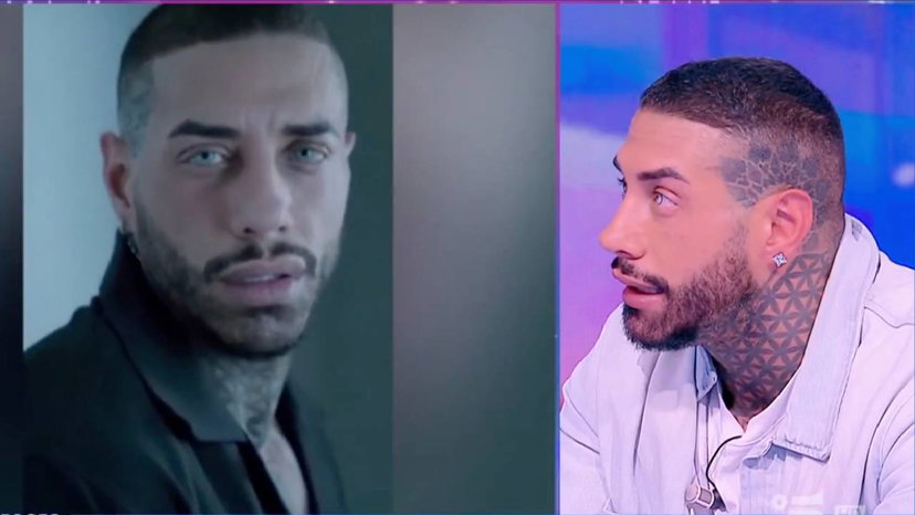 Chiofalo, 100.000 Euro in chirurgia: “Vittima. Chi ha pagato gli interventi” preview