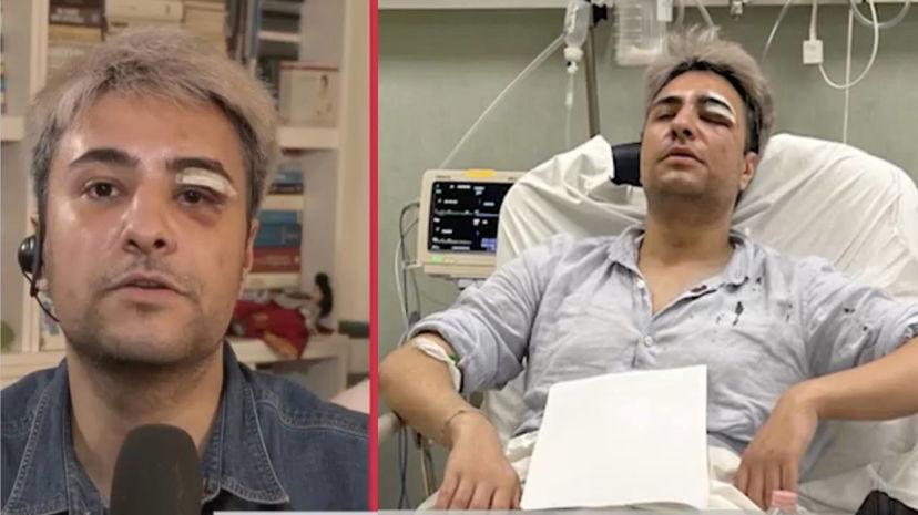 Alessandro aggredito perché gay: “Dieci contro di me” preview