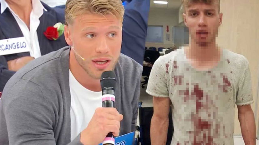 Marco Veneselli di Uomini e Donne, quando venne picchiato da due poliziotti preview