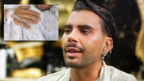 Federico Fashion Style, il prima e dopo la sua operazione di chirurgia estetica preview