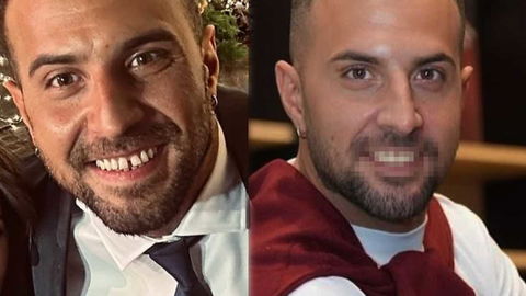 Antonio Panico con i denti nuovi: ecco le foto del prima e del dopo preview