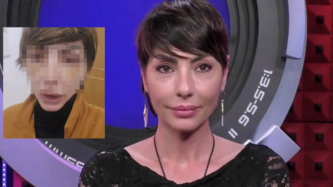 Ilaria Galassi si mostra dopo un’operazione di chirurgia estetica e poi si sfoga preview