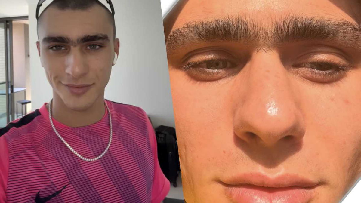 Achille Costacurta sul monociglio: “Lo toglierei per un solo motivo” article-post