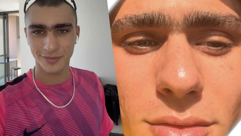 Achille Costacurta sul monociglio: “Lo toglierei per un solo motivo” preview