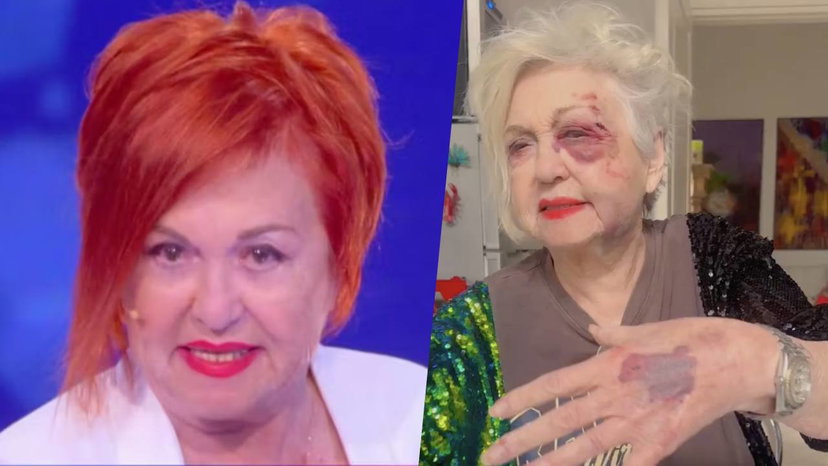 Wanna Marchi investita da un’auto a Milano: “Sono devastata. L’ho vista arrivarmi addosso” preview