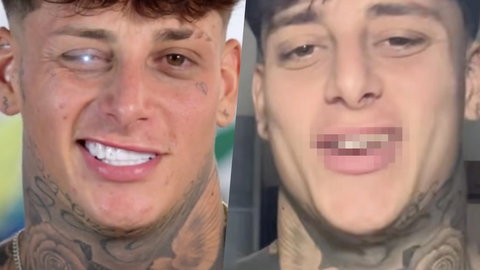 Stefano Modica di Italia Shore: le foto dei suoi denti prima delle faccette preview