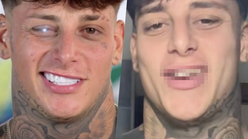 Stefano Modica di Italia Shore: le foto dei suoi denti prima delle faccette preview